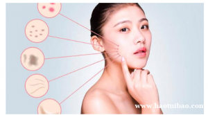 科茵特祛斑祛痘加盟怎么样